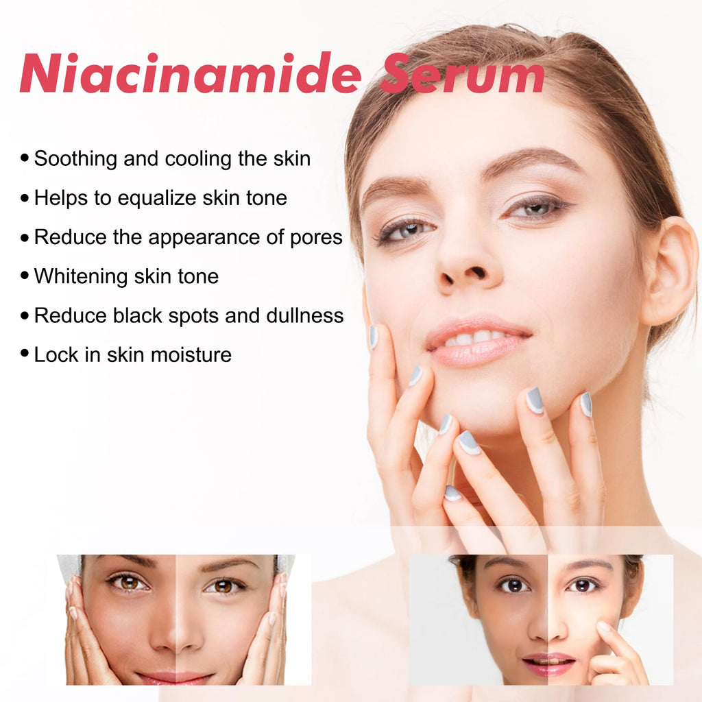 Hoygi Niacinamide Face Serum Firming Skin Fade Fine Lines Pore Shrink Remove Dark Spots Smoothing Skin Glowing Face Serum