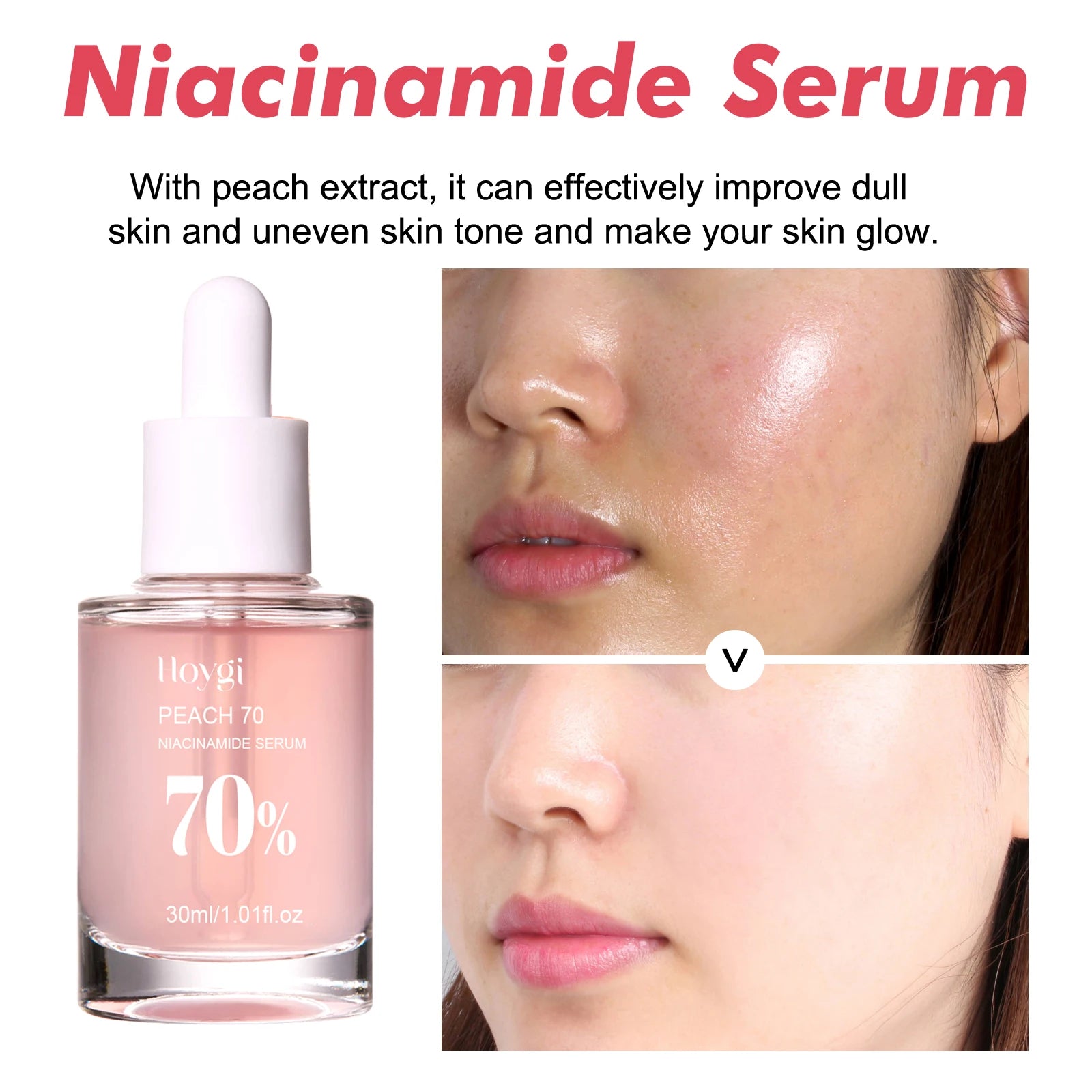Hoygi Niacinamide Face Serum Firming Skin Fade Fine Lines Pore Shrink Remove Dark Spots Smoothing Skin Glowing Face Serum
