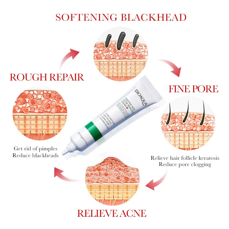 Salicylic Acid Face Cream for Clear Balanced Skin