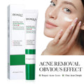 Salicylic Acid Face Cream for Clear Balanced Skin