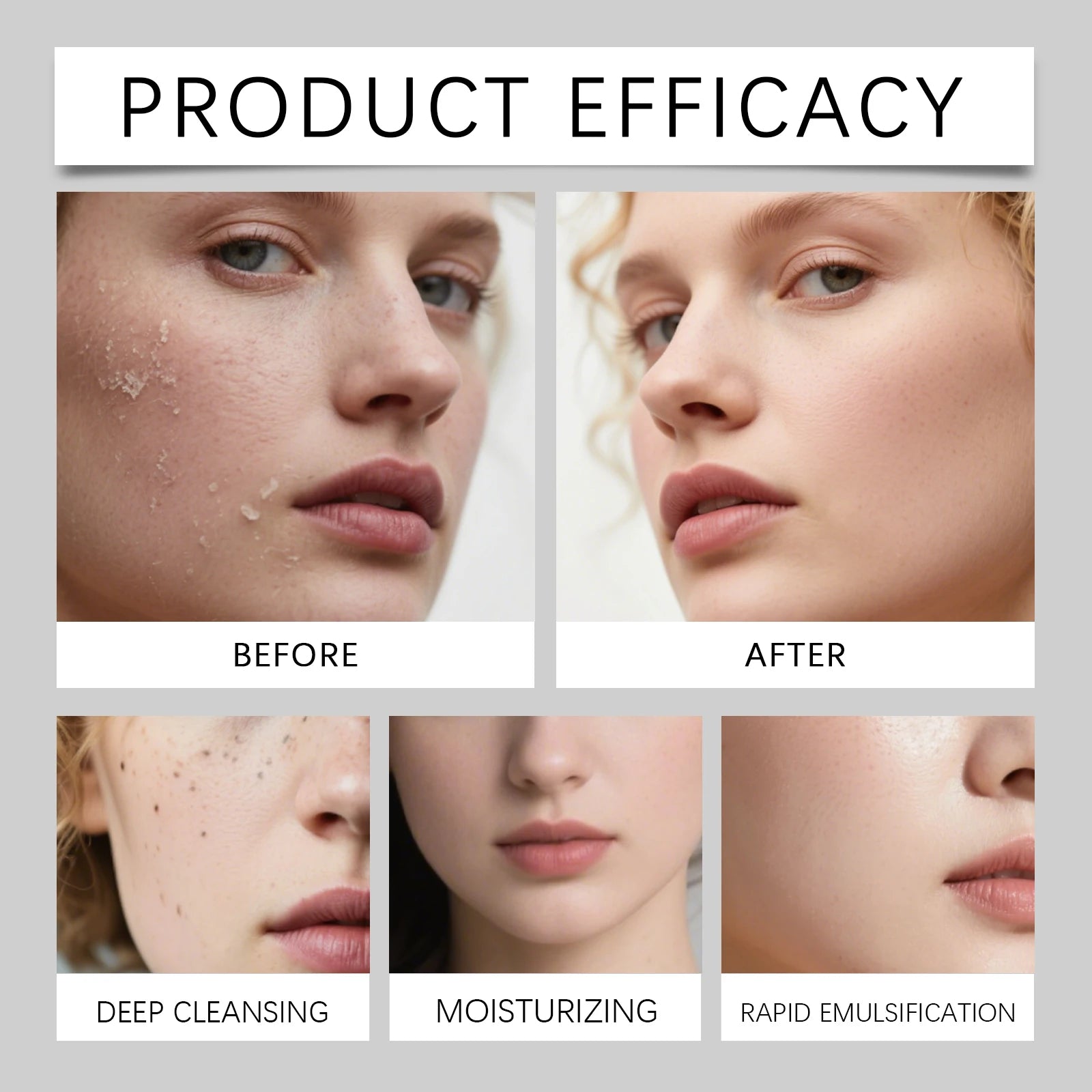 HOYGI Nicotinamide Whitening Spray Skin Brightening Moisturizing Aloe Toner Hydrating Repair Soothing Face Mist Dry Skin Care