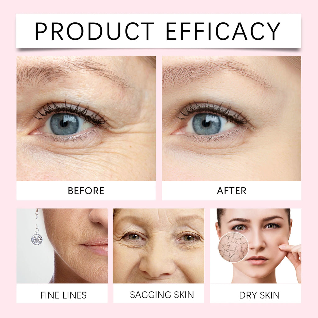 Organic Rosehip Oil Improve Fine Lines Wrinkles Firming Lifting Repair Smoothing Shiny Hair Oil Facial Essential Oils Skincare